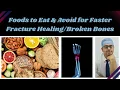 What to Eat After a Fracture | Bone Healing Foods, Myths & Recovery Tips