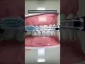 Dentist Reveals How YOU Are Brushing WRONG