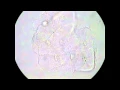 Examination of Vaginal Wet Preps