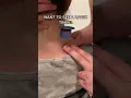Magically Making The Most Common Chronic Neck Pain Spot Go Away Myofascial Releas