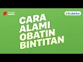 Download Lagu 2 Cara Alami Mengatasi Mata Bintitan #Shorts