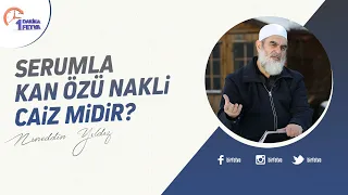 Serumla kan özü nakli caiz midir?