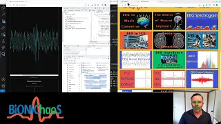 Optimizing EEG Data Visualization with Fuzzy Logic and JavaScript
