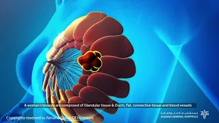 ما هو فحص الماموجرام 