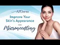 Microneedling Procedure to Improve Skin s Appearance