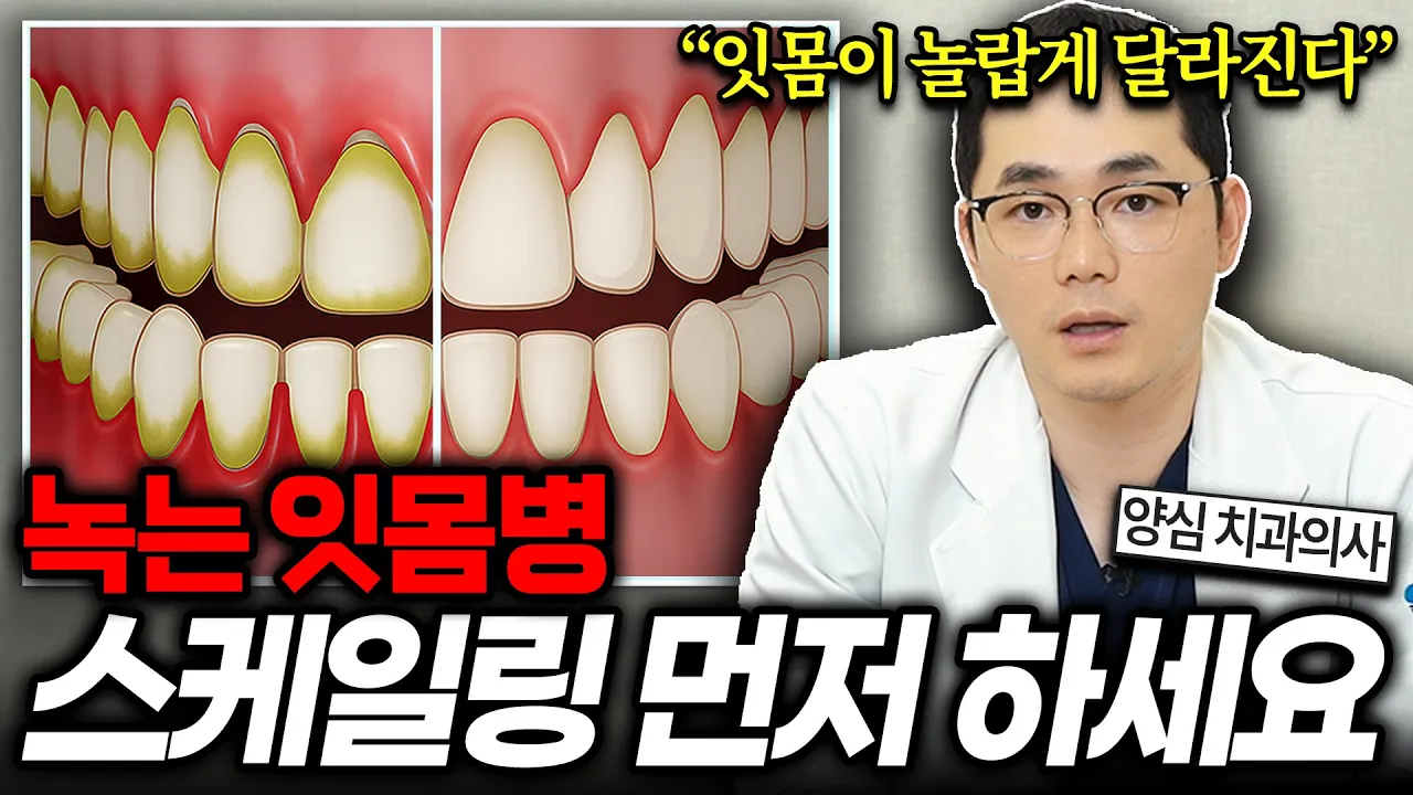[강남치과] 스케일링 후 시리고 잇몸에 구멍이 났다면 봐야 할 영상. 치과에서 임플란트 전에 스케일링 먼저 하는 이유 #신사동치과 #신사역치과