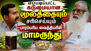 எப்படிப்பட்ட கடுமையான மூலத்தையும் சரிசெய்யும் பாரம்பரிய வைத்தியரின் மாமருந்து..