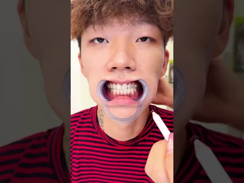 Trouble while giving him red diamond Tooth Gems😬♦️