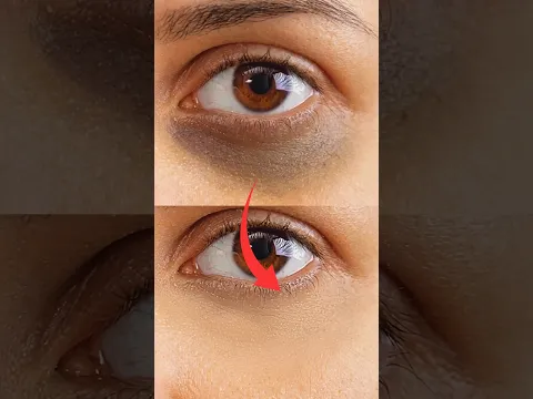 Remove Deep Dark Circles in Photoshop #adobe #photoshop #smartgraphic