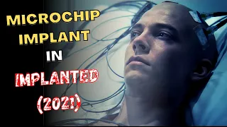 microchip implant in 