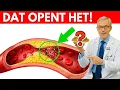 Lagu #1 Het Beste Voedsel om Je Slagaders Natuurlijk te Reinigen – Wetenschappelijk Bewezen!