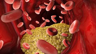 Colesterol: biossíntese, transporte e absorção