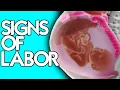 2 Signs of Labor from a Midwife - Are You IN LABOR Losing Mucus Plug vs Water Breaking