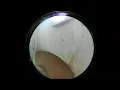 OBSEA CAM Crawler 2