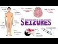 Download Lagu Seizures - Seizure Types | Generalized vs Focal Seizures | Causes of Seizures (Mnemonic)