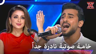 عذوبة استثنائية في الغناء تزلزل المسرح وتخطف قلوب الجمهور فوراً - اكس فاكتور الموسم 1