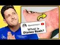 The Truth About The Disney Rash RTC 38