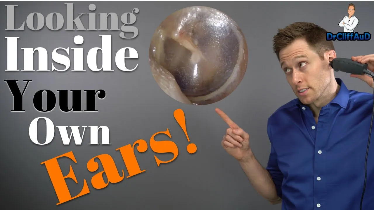 What's Inside Your Ears? | Clogged Ears & Ear Problems | Natus Otocam 300