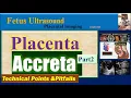 Placenta Accreta Spectrum PAS Ultrasound Part 2 Technical Tips Pitfalls Diagnosis