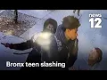 EXCLUSIVE Teen slashed in neck in The Bronx suspects still on the run