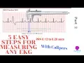 How to Measure and Interpret EKGs in 5 Easy Steps with Calipers