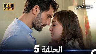 حب أعمى الحلقة 5 (4K) (Arabic Dubbed)
