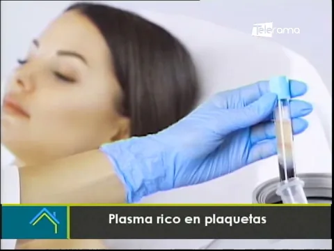 Estética al Día: Plasma rico en plaquetas