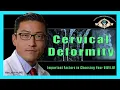 Cervical Deformity Important Factors in Choosing Your - Dr Han Jo Kim