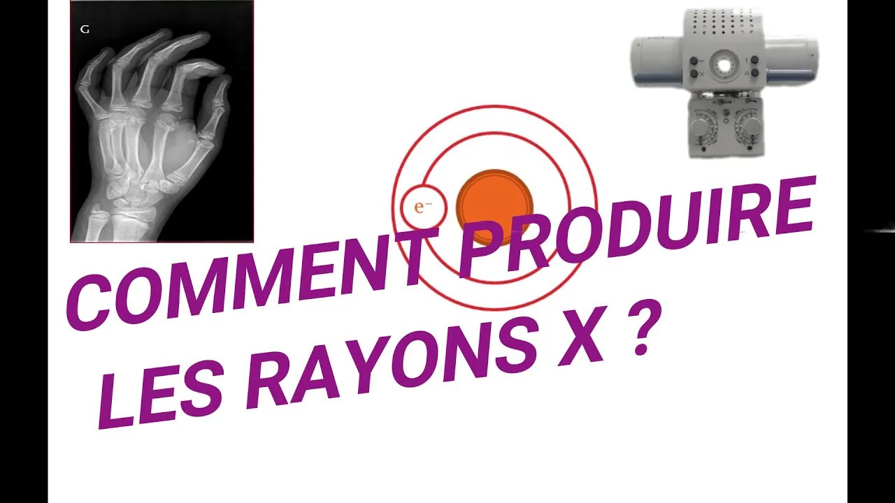 Comprendre Facilement Comment Produire les Rayons X/ Bases Physiques Radiologie et Imagerie Médicale