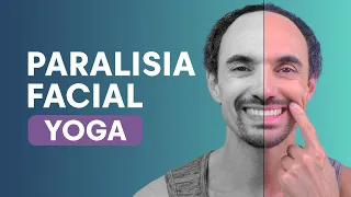 Yoga para Paralisia Facial | Paralisia de Bell ou assimetria no rosto