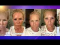 Baywatch Star Gena Lee Nolin Debuts the Results of Her Silent Lift