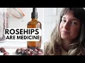 Making rosehip tincture trying chicory root coffee prepping my winter herbal remedies