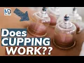 Cupping Therapy 101 Best Practices Benefits and Common Misconceptions Debunked