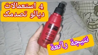 واش بصح يستاهل هاد الضجة   بيتادين والاستعمالات الخارجية للجسم والشعر   دندنها