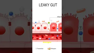 This Pill Can Wreck Your Gut in Days