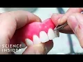 How Dentures Are Made The Making Of