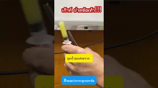  อาการบวมและปวดข้อเท้าที่ไม่ดีขึ้นใน 4-5 วัน มีสาเหตุจากอะไรได้บ้าง 