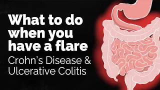 What to do if you have a Crohn s disease or ulcerative colitis flare GI Society