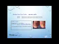 Podiatry Billing Coding for Success