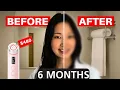 Dermatologist Is Medicube s 480 Antiaging Device WORTH IT