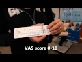 Welmed - Pain VAS Scale