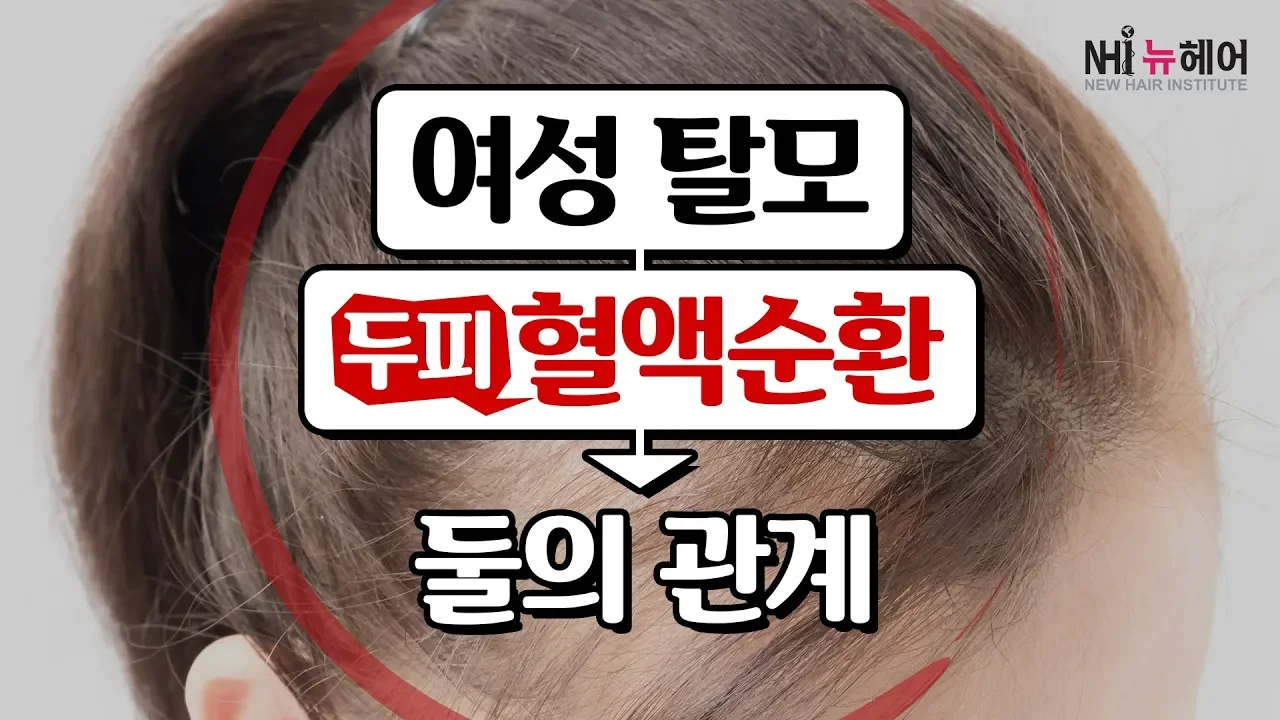 여성탈모와 두피 혈액순환의 관계 - 뉴헤어 I 모발이식 I 탈모QnA I