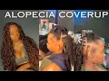 Alopecia Coverup Beginner Braid tutorial Bohemian Knotless Braid Tutorial