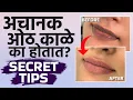 Download Lagu काळ्या ओठांना द्या गुलाबी Glow | Natural Lip Care Tips | Dark Lips Treatment Lokmat Sakhi | KP2