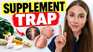 Dietary Supplements Causing Hair Loss & Acne? A Dermatologist Explains