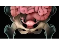 Download Lagu Endometriosis