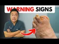 5 Signs You NEED to See a Foot Doctor Don t Ignore These