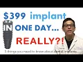 Dental Implants - 5 Things You Should Know About Dental Implants