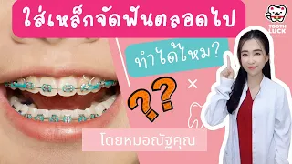  ทำไมการจัดฟันนานๆ ถึงอาจทำให้รากฟันเสียหายได้ 