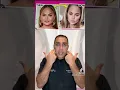 New Trending Cosmetic Surgery - Buccal Fat Removal Dr Lahijani